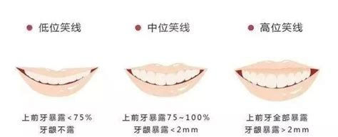 笑露下排牙齒面相|笑起來露出牙龈面相